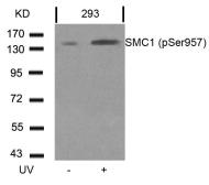 Anti-SMC1 (phospho Ser957) antibody used in Western Blot (WB). GTX50241