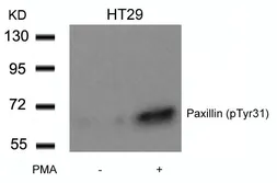 Anti-Paxillin (phospho Tyr31) antibody used in Western Blot (WB). GTX50243