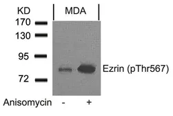 Anti-Ezrin (phospho Thr567) antibody used in Western Blot (WB). GTX50244