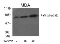 Anti-Raf1 (phospho Ser338) antibody used in Western Blot (WB). GTX50246