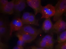 Anti-Synaptotagmin 1 (phospho Thr202) + Synaptotagmin 2 (phospho Thr199) antibody used in Immunocytochemistry/ Immunofluorescence (ICC/IF). GTX50250