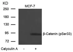 Anti-beta Catenin (phospho Ser33) antibody used in Western Blot (WB). GTX50255