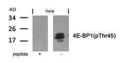 Anti-4E-BP1 (phospho Thr45) antibody used in Western Blot (WB). GTX50259