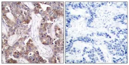 Anti-Stathmin 1 (phospho Ser25) antibody used in IHC (Paraffin sections) (IHC-P). GTX50260