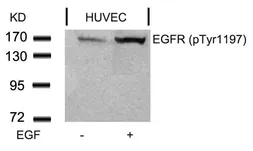 Anti-EGFR (phospho Tyr1173) antibody used in Western Blot (WB). GTX50263