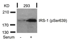 Anti-IRS1 (phospho Ser639) antibody used in Western Blot (WB). GTX50266