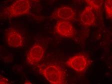 Anti-eIF4E (phospho Ser209) antibody used in Immunocytochemistry/ Immunofluorescence (ICC/IF). GTX50268
