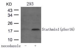 Anti-Stathmin 1 (phospho Ser16) antibody used in Western Blot (WB). GTX50269