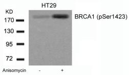 Anti-BRCA1 (phospho Ser1423) antibody used in Western Blot (WB). GTX50272
