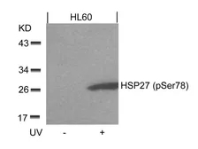 Anti-HSP27 (phospho Ser78) antibody used in Western Blot (WB). GTX50276