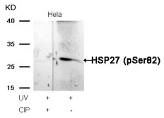 Anti-HSP27 (phospho Ser82) antibody used in Western Blot (WB). GTX50277