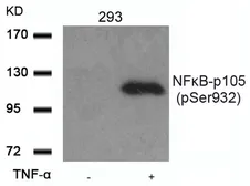 Anti-NFkB p105 (phospho Ser932) antibody used in Western Blot (WB). GTX50279