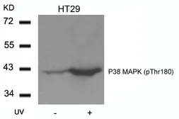 Anti-p38 MAPK (phospho Thr180) antibody used in Western Blot (WB). GTX50280