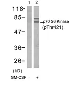 Anti-p70 S6K (phospho Thr421) antibody used in Western Blot (WB). GTX50282