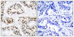 Anti-RelB (phospho Ser573) antibody used in IHC (Paraffin sections) (IHC-P). GTX50283