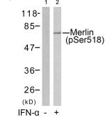 Anti-Merlin (phospho Ser518) antibody used in Western Blot (WB). GTX50291
