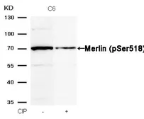 Anti-Merlin (phospho Ser518) antibody used in Western Blot (WB). GTX50291