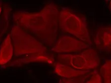 Anti-p70 S6K (phospho Ser411) antibody used in Immunocytochemistry/ Immunofluorescence (ICC/IF). GTX50294
