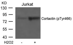 Anti-Cortactin (phospho Tyr466) antibody used in Western Blot (WB). GTX50295