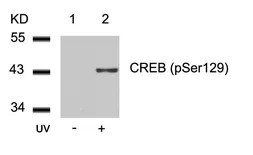 Anti-CREB (phospho Ser129) antibody used in Western Blot (WB). GTX50296