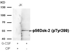 Anti-DOK2 (phospho Tyr299) antibody used in Western Blot (WB). GTX50299