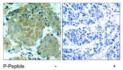 Anti-eIF2 alpha (phospho Ser51) antibody used in IHC (Paraffin sections) (IHC-P). GTX50300