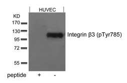 Anti-Integrin beta 3 (phospho Tyr785) antibody used in Western Blot (WB). GTX50303