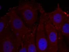 Anti-alpha Synuclein (phospho Tyr133) antibody used in Immunocytochemistry/ Immunofluorescence (ICC/IF). GTX50305