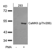 Anti-CaMKII alpha (phospho Thr286) antibody used in Western Blot (WB). GTX50307
