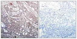 Anti-IKB beta (phospho Ser23) antibody used in IHC (Paraffin sections) (IHC-P). GTX50317