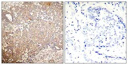 Anti-Cytokeratin 18 (phospho Ser33) antibody used in IHC (Paraffin sections) (IHC-P). GTX50318
