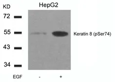 Anti-Cytokeratin 8 (phospho Ser74) antibody used in Western Blot (WB). GTX50320