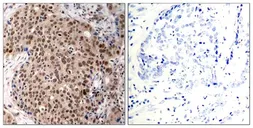 Anti-MAPKAPK-2 (phospho Thr334) antibody used in IHC (Paraffin sections) (IHC-P). GTX50321