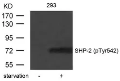 Anti-SHP2 (phospho Tyr542) antibody used in Western Blot (WB). GTX50328