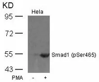 Anti-Smad1 (phospho Ser465) antibody used in Western Blot (WB). GTX50330