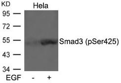 Anti-SMAD3 (phospho Ser425) antibody used in Western Blot (WB). GTX50333