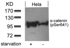 Anti-alpha 1 Catenin (phospho Ser641) antibody used in Western Blot (WB). GTX50338