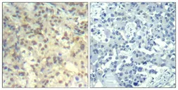 Anti-Cofilin 1 (phospho Tyr140) antibody used in IHC (Paraffin sections) (IHC-P). GTX50340