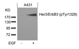 Anti-Her3 / ErbB3 (phospho Tyr1328) antibody used in Western Blot (WB). GTX50341