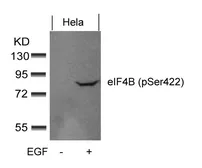 Anti-eIF4B (phospho Ser422) antibody used in Western Blot (WB). GTX50343