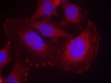 Anti-PLCG1 (phospho Tyr771) antibody used in Immunocytochemistry/ Immunofluorescence (ICC/IF). GTX50346