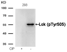 Anti-Lck (phospho Tyr505) antibody used in Western Blot (WB). GTX50349