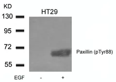 Anti-Paxillin (phospho Tyr88) antibody used in Western Blot (WB). GTX50350