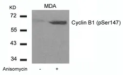 Anti-Cyclin B1 (Phospho Ser147) antibody used in Western Blot (WB). GTX50351