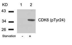 Anti-CDK6 (Phospho Tyr24) antibody used in Western Blot (WB). GTX50353