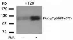 Anti-FAK (phospho Tyr576/577) antibody used in Western Blot (WB). GTX50354