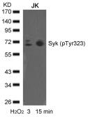 Anti-Syk (phospho Tyr323) antibody used in Western Blot (WB). GTX50355