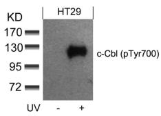 Anti-CBL (phospho Tyr700) antibody used in Western Blot (WB). GTX50356