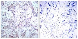 Anti-NFkB p65 antibody used in IHC (Paraffin sections) (IHC-P). GTX50374