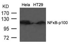 Anti-NFkB p100 antibody used in Western Blot (WB). GTX50375